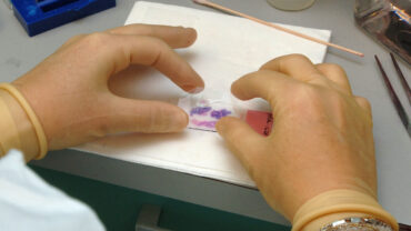 histological examination