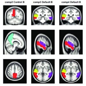 Associative learning