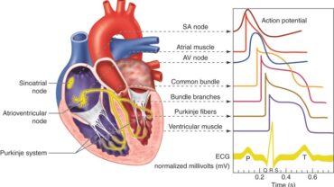 Atrioventricular valve